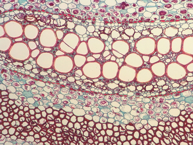 Fern Stem Slides - Fernstem 02 200X